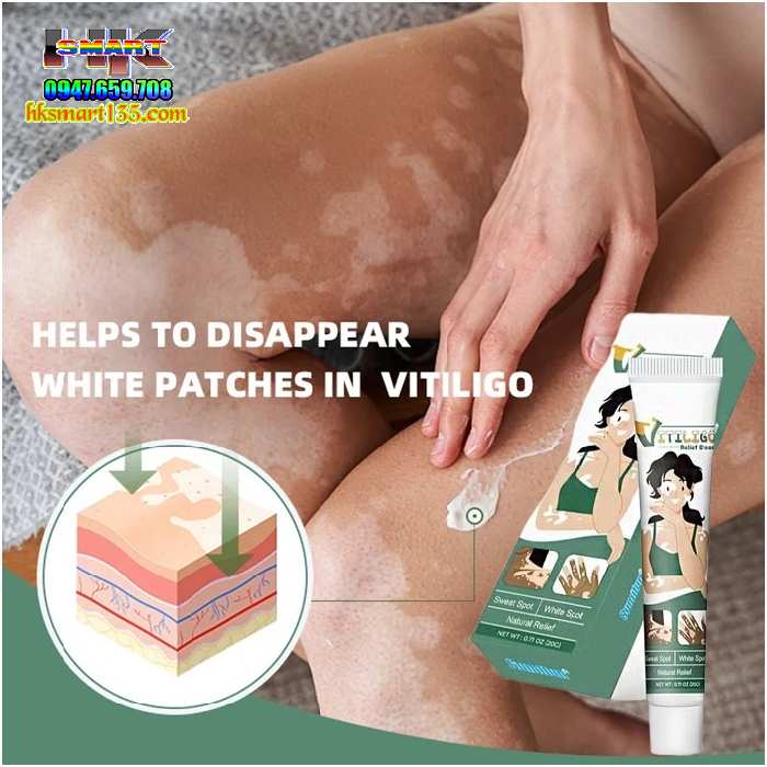 Kem Bôi Bạch Biến Lang Ben Vitiligo South Moon-20gr- Trị Mờ Bạch Biến Đốm Trắng Nám Thâm Hiệu Quả