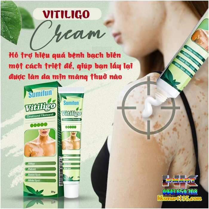 Kem bôi bạch biến lang ben Vitiligo - 20gr làm mờ bạch biến đốm trắng