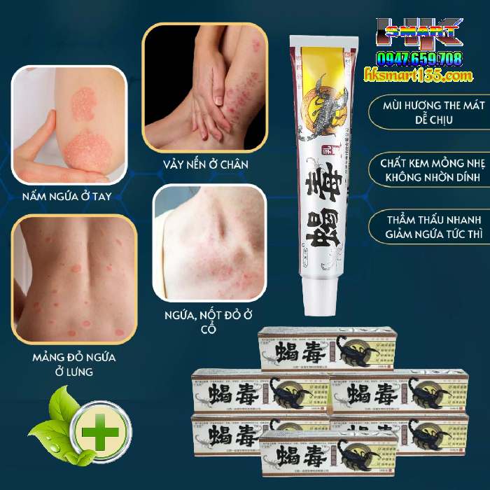 Kem Bôi Da Liễu Bọ Cạp Đông Y Thảo Dược Nội Địa Trung