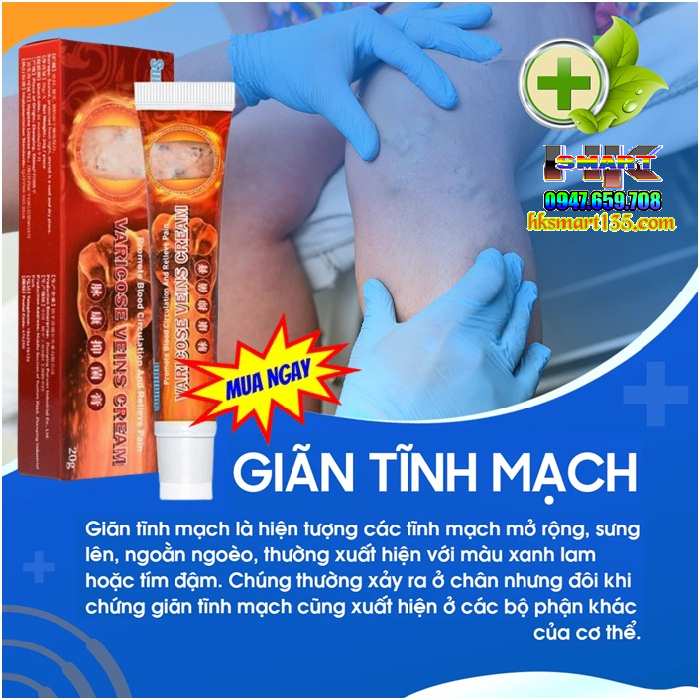 Kem Chống Suy Giãn Phồng Tĩnh Mạch Varicose Veins Cream Sumifun 20Gr