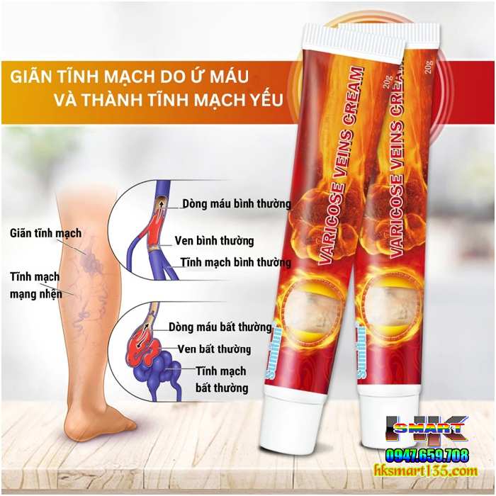 Kem Chống Suy Giãn Phồng Tĩnh Mạch Varicose Veins Cream Sumifun 20Gr