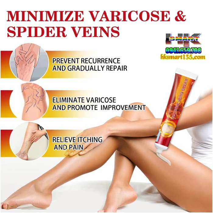 Kem Chống Suy Giãn Phồng Tĩnh Mạch Varicose Veins Cream Sumifun 20Gr