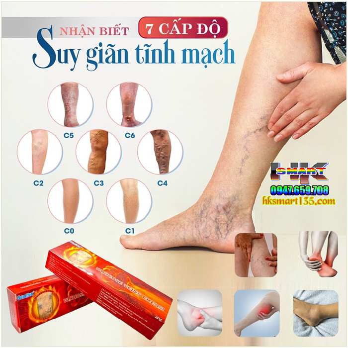 Kem Chống Suy Giãn Phồng Tĩnh Mạch Varicose Veins Cream Sumifun 20Gr