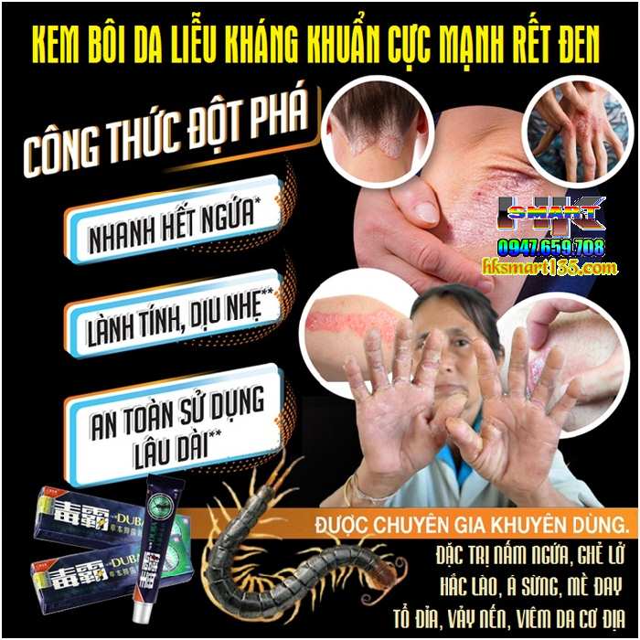 Kem Bôi Da Liễu Kháng Khuẩn Cực Mạnh Rết Đen Đặc Trị Nấm Ngứa, Ghẻ Lở, Hắc Lào, Á Sừng, Mề Đay, Tổ Đỉa, Vảy Nến, Viêm Da Cơ Địa