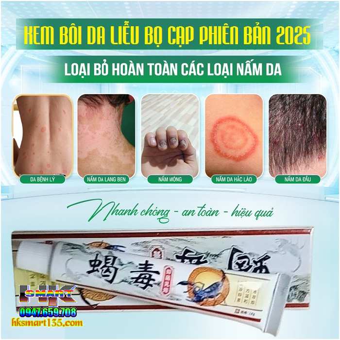 Kem Bôi Da Liễu Bọ Cạp Phiên Bản 2025 Đặc Trị Nấm Ngứa, Ghẻ Lở, Hắc Lào, Á Sừng, Mề Đay, Tổ Đỉa, Vảy Nến, Viêm Da Cơ Địa