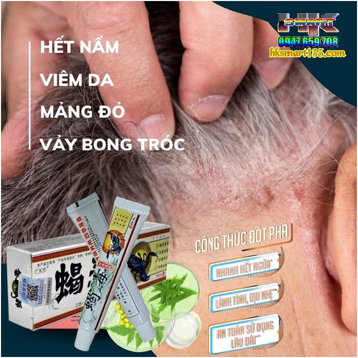 Kem Bôi Da Liễu Bọ Cạp Phiên Bản 2025 Đặc Trị Nấm Ngứa, Ghẻ Lở, Hắc Lào, Á Sừng, Mề Đay, Tổ Đỉa, Vảy Nến, Viêm Da Cơ Địa