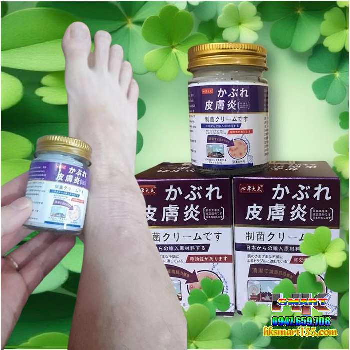 Kem bôi Nakusa đặc trị viêm da cơ địa, á sừng, vảy nến đến từ Nhật Bản