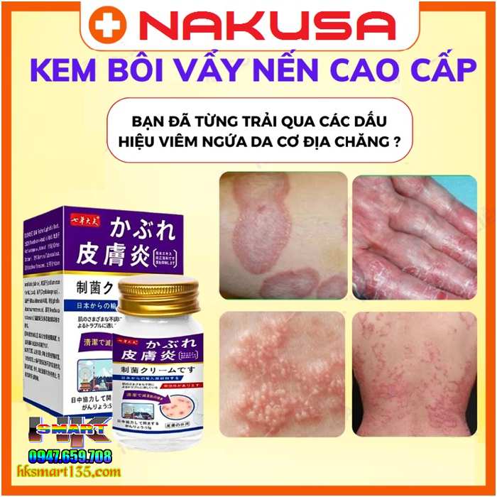 Kem bôi Nakusa đặc trị viêm da cơ địa, á sừng, vảy nến đến từ Nhật Bản