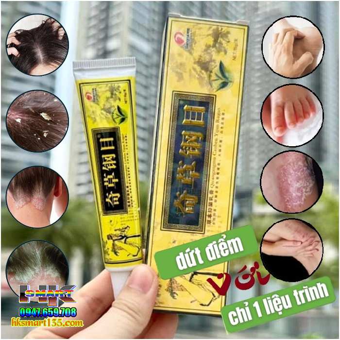ZUDAIFU 15GR- Kem bôi đặc trị nấm ngứa, nứt nẻ, nấm móng tay chân
