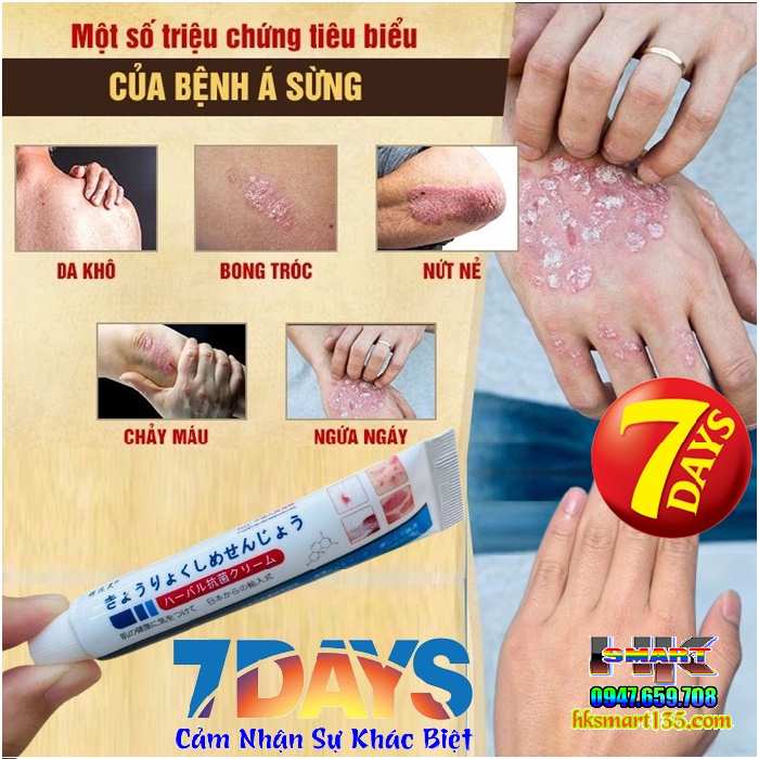 Kem bôi đặc trị viêm da cơ địa á sừng vảy nến Nhật Bản