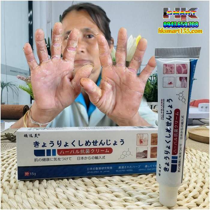 Kem bôi đặc trị viêm da cơ địa, á sừng, vảy nến Nhật Bản