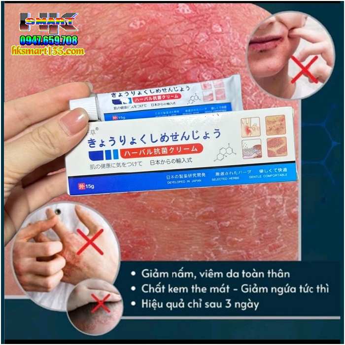 Kem bôi đặc trị viêm da cơ địa á sừng vảy nến Nhật Bản