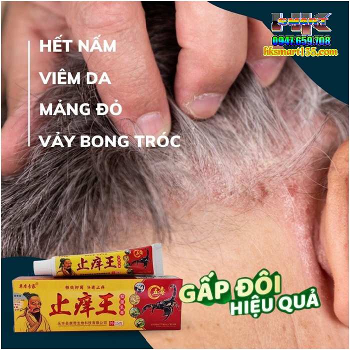 Kem Bôi Bọ Cạp Đặc Trị Viêm Da Cơ địa, Á Sừng, Vảy Nến Thần Y Hoa Đà,