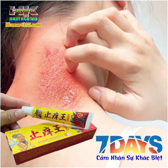 Kem Bôi Bọ Cạp Đặc Trị Viêm Da Cơ địa, Á Sừng, Vảy Nến Thần Y Hoa Đà,