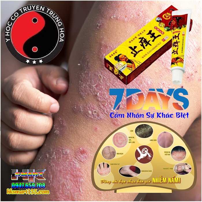Kem Bôi Bọ Cạp Đặc Trị Viêm Da Cơ địa, Á Sừng, Vảy Nến Thần Y Hoa Đà,
