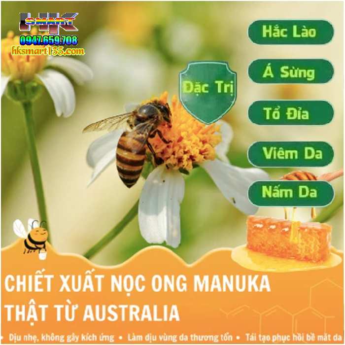 Kem Bôi Nọc Ong Đặc Trị Nấm Ngứa, mụn Nước Hbesty 20gr- Cho Da Viêm, Chàm Eczema, tổ Đỉa, Vẩy Nến Á Sừng