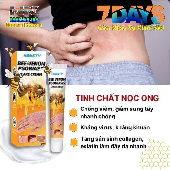 Kem Bôi Nọc Ong Đặc Trị Nấm Ngứa, mụn Nước Hbesty 20gr- Cho Da Viêm, Chàm Eczema, tổ Đỉa, Vẩy Nến Á Sừng