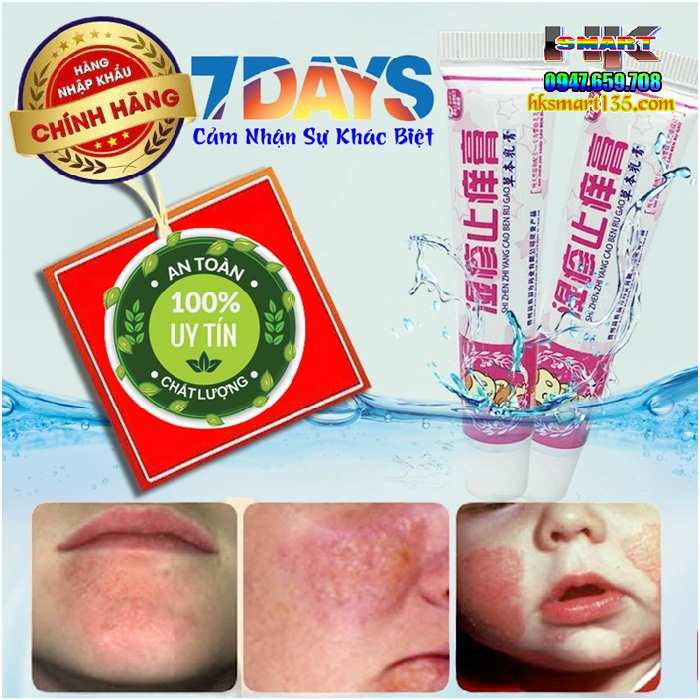 Kem Bôi Thảo Mộc Chuyên Nấm Ngứa Chàm Sữa Côn Trùng Đốt Ben Ru Gao 15gr Dành Riêng Cho Bé