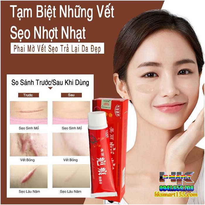 Kem Bôi Thảo Mộc Xóa Sẹo- Trị Rạn Da Fujiemeibao 60gr