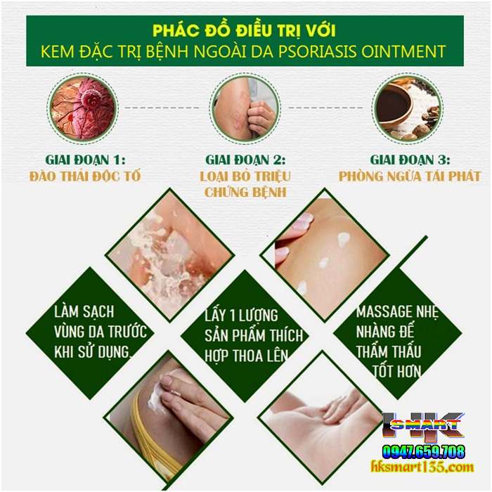 Kem bôi vảy nến HEALMUSZ Psoriasis Ointment xuất Mỹ