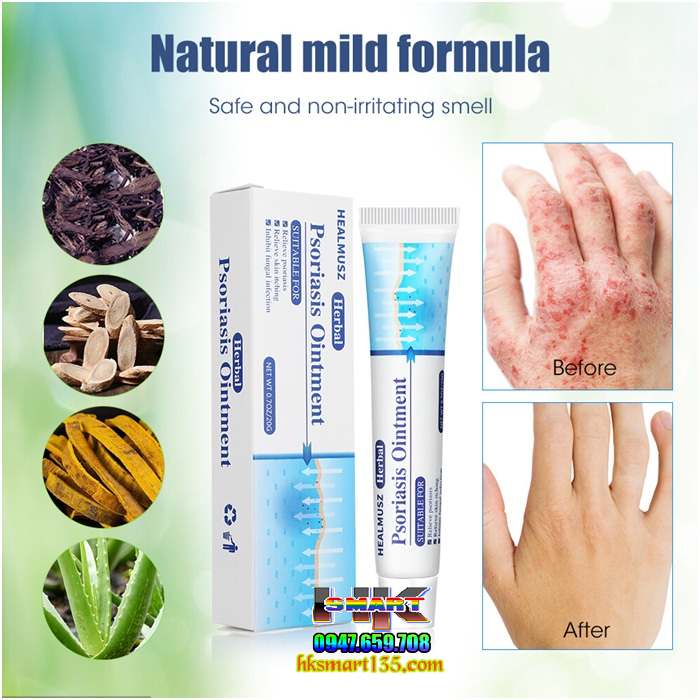 Kem bôi vảy nến HEALMUSZ Psoriasis Ointment xuất Mỹ