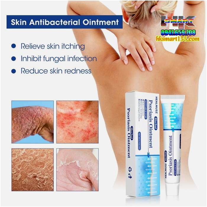 Kem bôi vảy nến HEALMUSZ Psoriasis Ointment xuất Mỹ