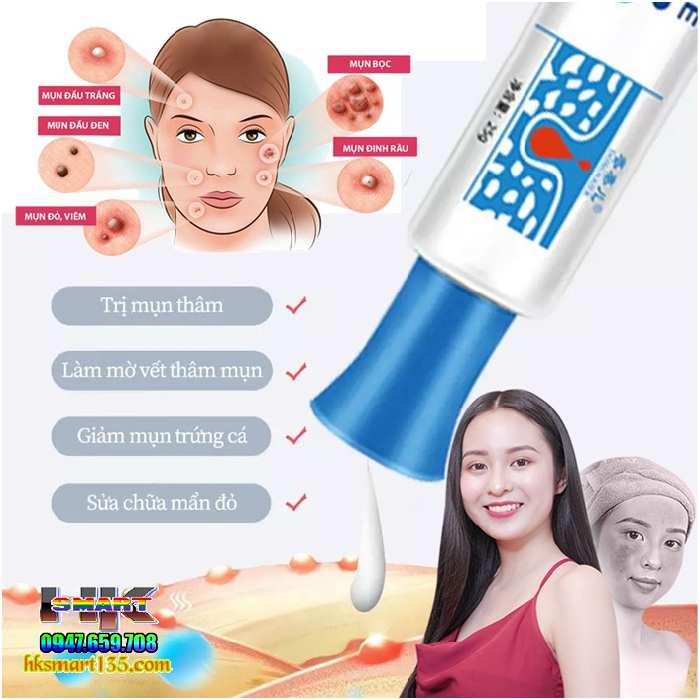 Kem Chấm Mụn Cấp Tốc Dongnaier 25gr- Loại Bỏ Nhanh Chóng Các Loại Mụn