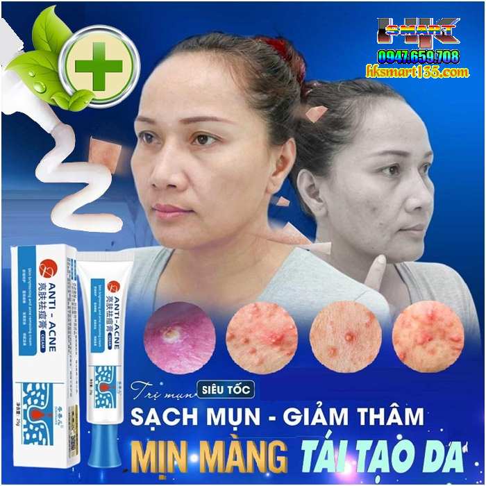 Kem Chấm Mụn Cấp Tốc Dongnaier 25gr- Loại Bỏ Nhanh Chóng Các Loại Mụn