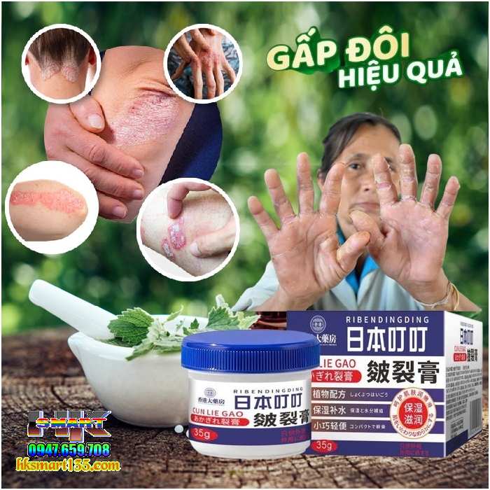 Ubis- Kem Đặc Hiệu Nấm Ngứa Đông Y Thảo Dược Nội Địa Trung