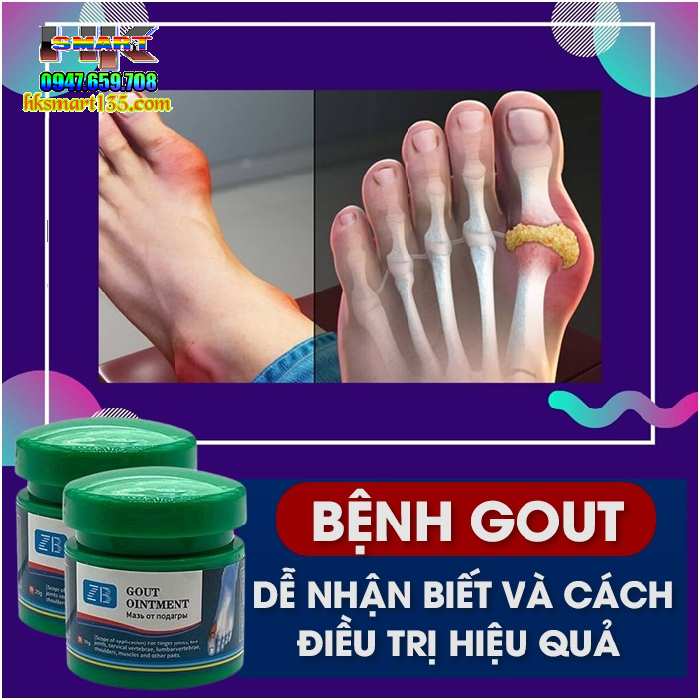 Kem Giảm Đau Sưng Gout Khớp Ngón Tay Và Ngón Chân Pain Relief Cream/gout Ointment/20g