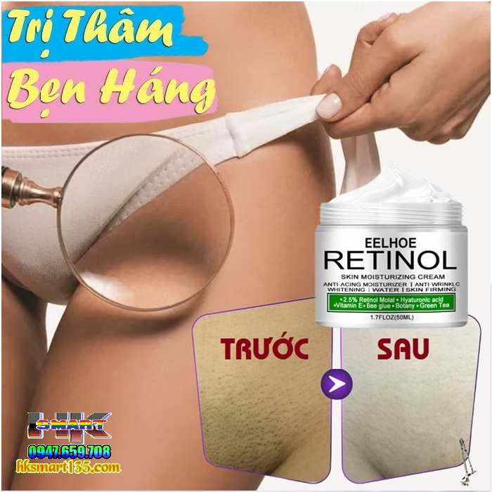 Kem Retinol Eelhoe 30gr-Dưỡng Ẩm Làm Trắng Sáng Da Cô Cậu Nhỏ, Hồng Nhũ Hoa, Vùng Nách, Đầu Gối, Khuỷu Tay, Bikini