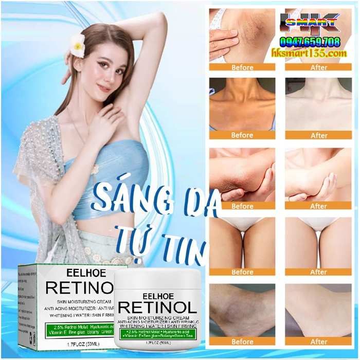 Kem Retinol Eelhoe 30gr-Dưỡng Ẩm Làm Trắng Sáng Da Cô Cậu Nhỏ, Hồng Nhũ Hoa, Vùng Nách, Đầu Gối, Khuỷu Tay, Bikini