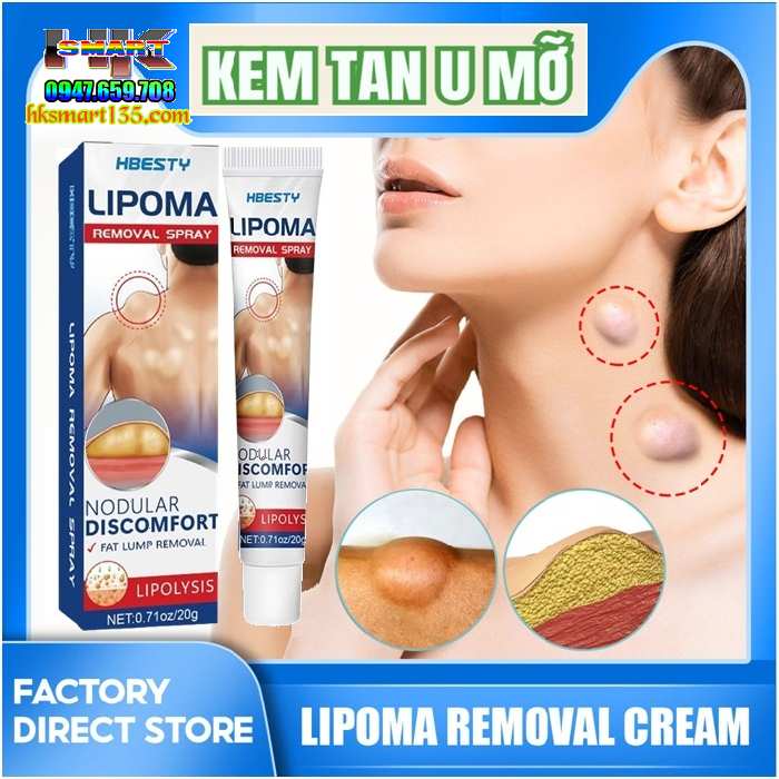 Kem Loại Bỏ Đánh Tan U Mỡ Bướu Cổ Hbesty Lipoma Nodular 20gr- Thảo Dược Thiên Nhiên