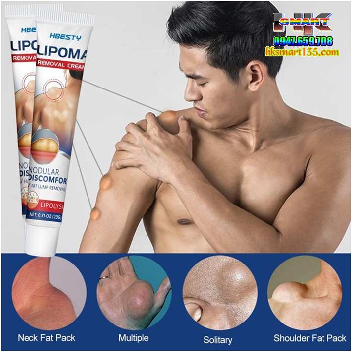 Kem Loại Bỏ Đánh Tan U Mỡ Bướu Cổ Hbesty Lipoma Nodular 20gr- Thảo Dược Thiên Nhiên