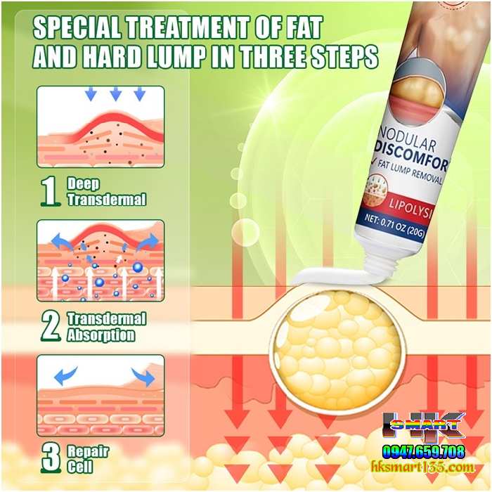 Kem Loại Bỏ Đánh Tan U Mỡ Bướu Cổ Hbesty Lipoma Nodular 20gr- Thảo Dược Thiên Nhiên