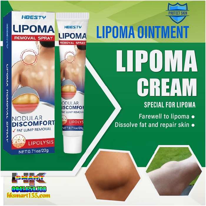 Kem Loại Bỏ Đánh Tan U Mỡ Bướu Cổ Hbesty Lipoma Nodular 20gr- Thảo Dược Thiên Nhiên