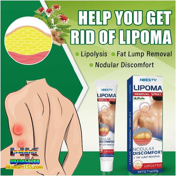 Kem Loại Bỏ Đánh Tan U Mỡ Bướu Cổ Hbesty Lipoma Nodular 20gr- Thảo Dược Thiên Nhiên