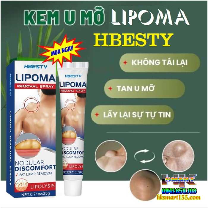 Kem Loại Bỏ Đánh Tan U Mỡ Bướu Cổ Hbesty Lipoma Nodular 20gr- Thảo Dược Thiên Nhiên