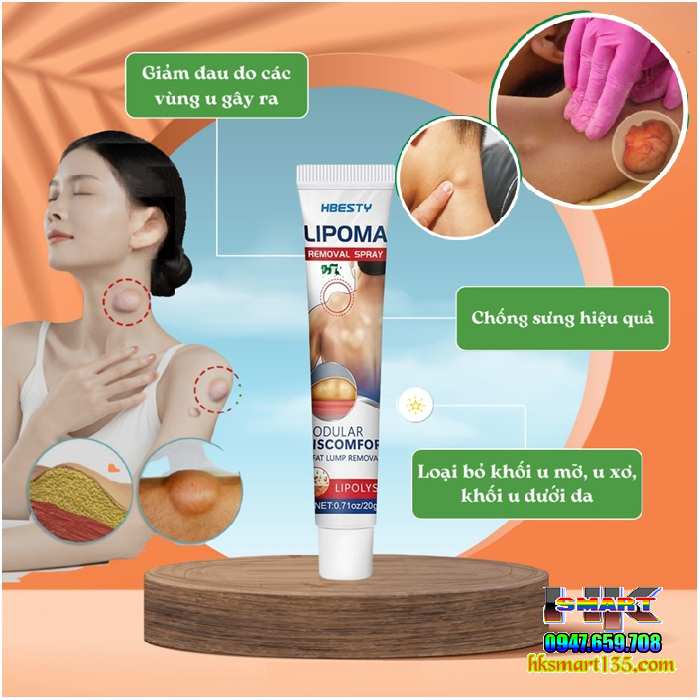 Kem Loại Bỏ Đánh Tan U Mỡ Bướu Cổ Hbesty Lipoma Nodular 20gr- Thảo Dược Thiên Nhiên