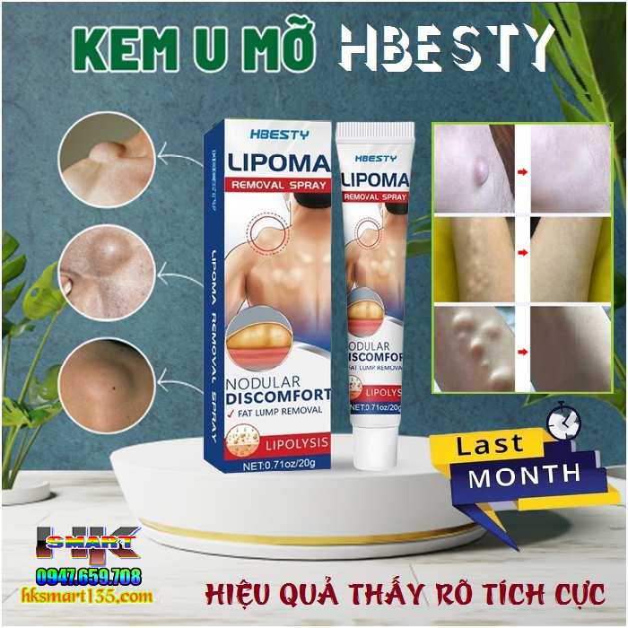 Kem Loại Bỏ Đánh Tan U Mỡ Bướu Cổ Hbesty Lipoma Nodular 20gr- Thảo Dược Thiên Nhiên