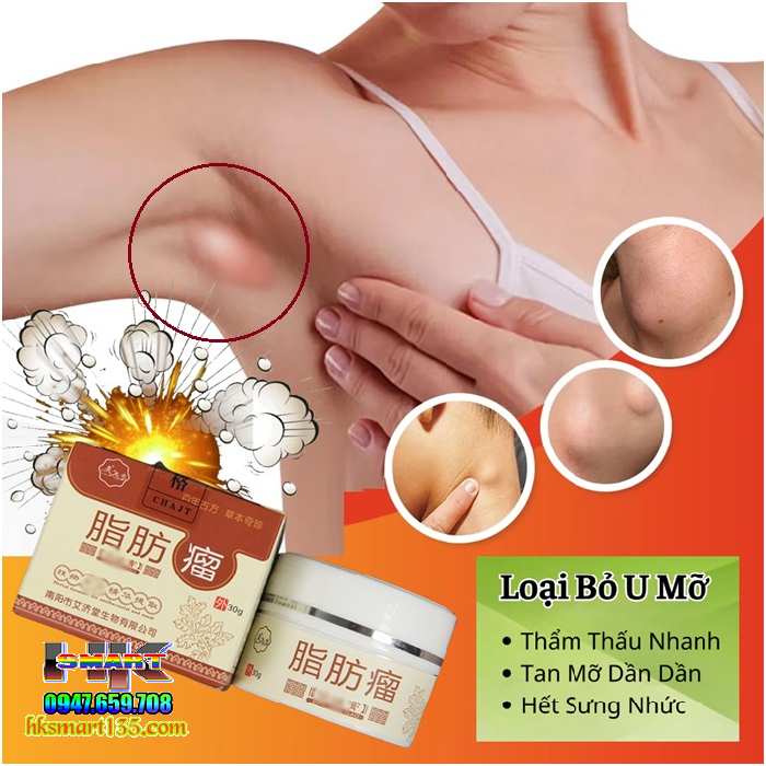 Hũ Kem Thảo Mộc Loại Bỏ Đánh Tan U Mỡ Bướu Cổ Nanyang Lipoma 30gr