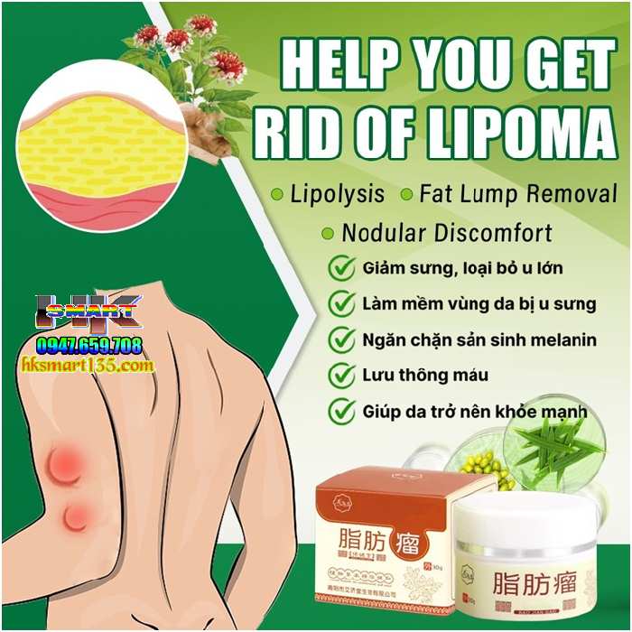 Hũ Kem Thảo Mộc Loại Bỏ Đánh Tan U Mỡ Bướu Cổ Nanyang Lipoma 30gr