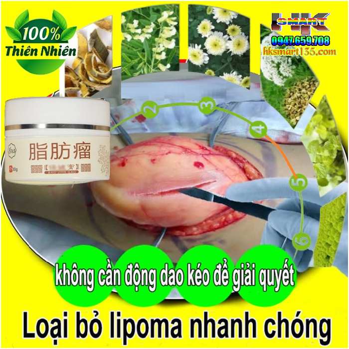 Hũ Kem Thảo Mộc Loại Bỏ Đánh Tan U Mỡ Bướu Cổ Nanyang Lipoma 30gr