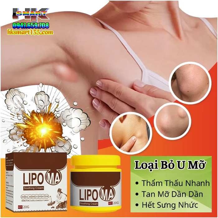 Hũ Kem Thảo Mộc Loại Bỏ Đánh Tan U Mỡ Bướu Cổ Shoothing Lipoma 20gr