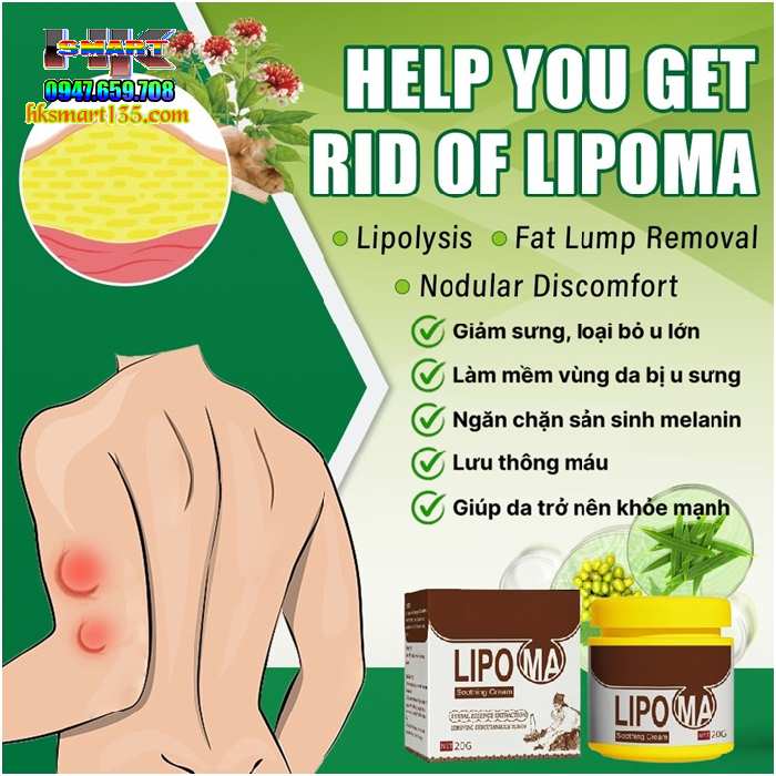 Hũ Kem Thảo Mộc Loại Bỏ Đánh Tan U Mỡ Bướu Cổ Shoothing Lipoma 20gr
