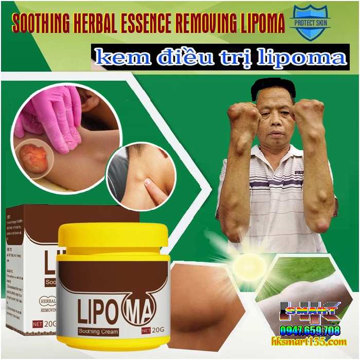 Hũ Kem Thảo Mộc Loại Bỏ Đánh Tan U Mỡ Bướu Cổ Shoothing Lipoma 20gr