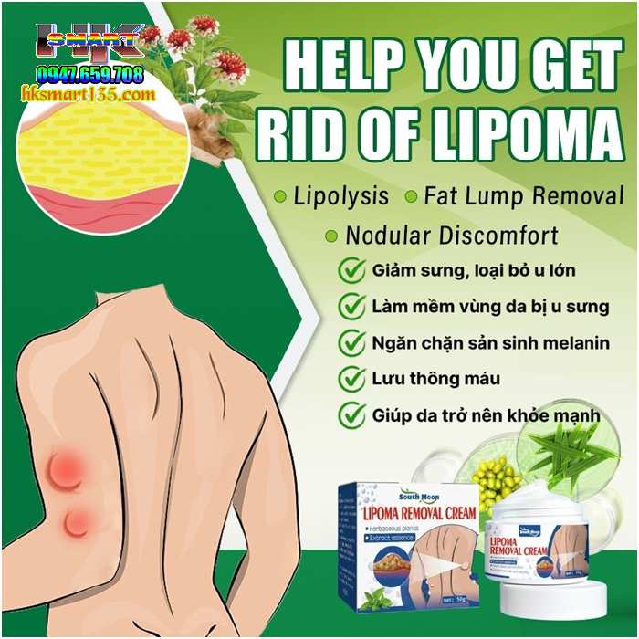 Hũ Kem Thảo Mộc Loại Bỏ Đánh Tan U Mỡ Bướu Cổ ShootMoon Lipoma 50gr
