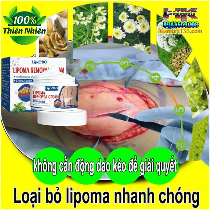 Hũ Kem Thảo Mộc Loại Bỏ Đánh Tan U Mỡ Bướu Cổ ShootMoon Lipoma 50gr