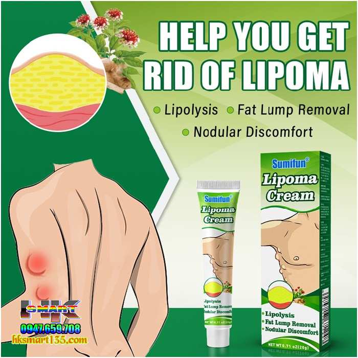 Kem Loại Bỏ Đánh Tan U Mỡ Bướu Cổ Tuyến Giáp Dưới Da Sumifun Lipoma Lipolysis 20gr
