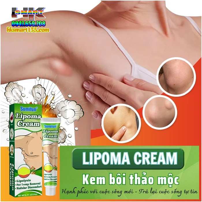 Kem Loại Bỏ Đánh Tan U Mỡ Bướu Cổ Tuyến Giáp Dưới Da Sumifun Lipoma Lipolysis 20gr